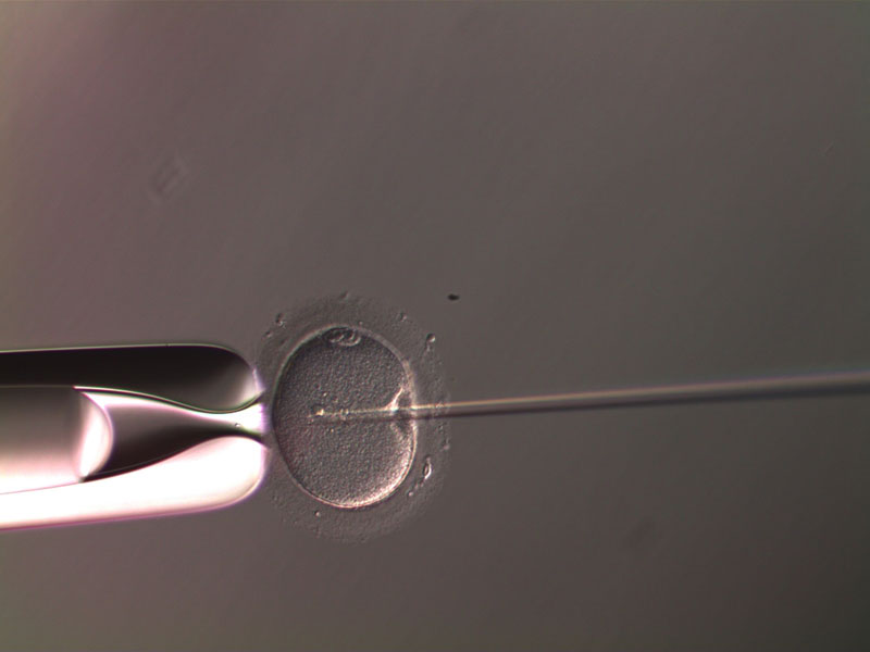Sperm Microinjection ICSI