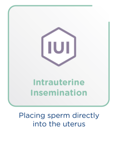 Learn more about Intrauterine Insemination (IUI)
